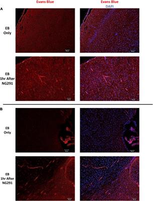 The Bradykinin B2 Receptor Agonist (NG291) Causes Rapid Onset of Transient Blood–Brain Barrier Disruption Without Evidence of Early Brain Injury